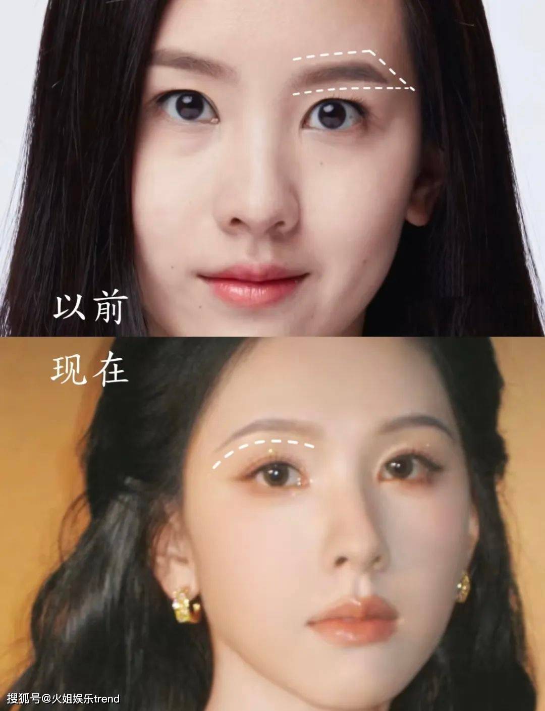 陈都灵是不是医美了?