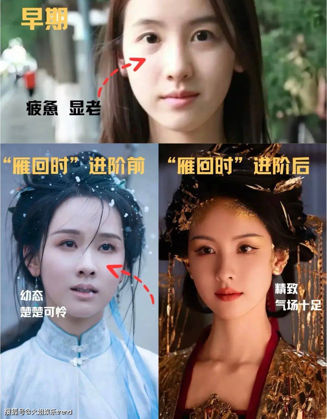 陈都灵是不是医美了?